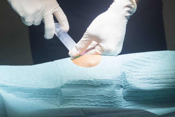 medical malpractice attorneys, medical malpractice, orthopedic malpractice, messalaw, messa and assocaiates, knee replacement malpractice, orthopedic lawyer